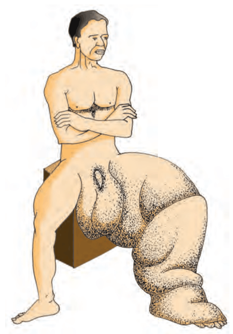 Textbook figure