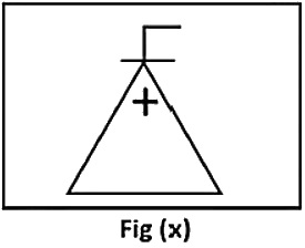 Question figure